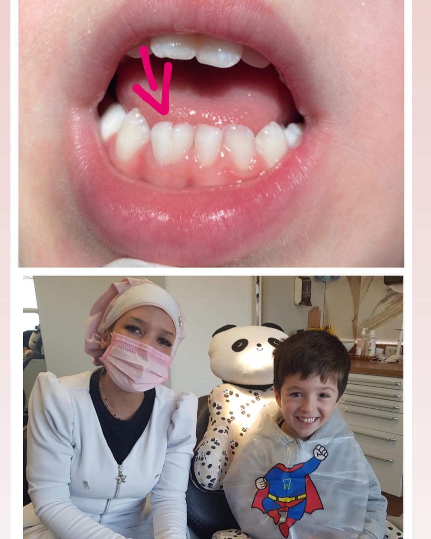 Diagnóstico de geminação dental